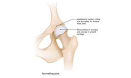 Healthy hip joint Image