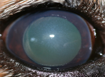 Corneal oedema by David Gould