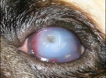 Corneal oedema associated with a deep corneal ulcer by David Gould